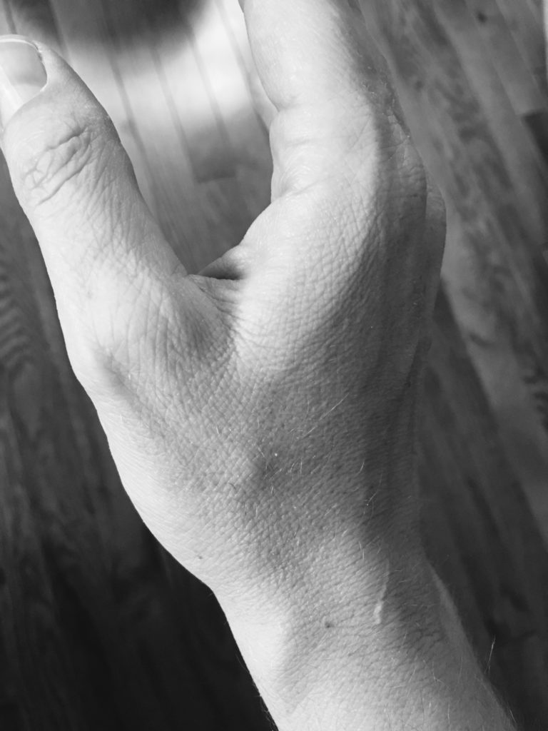 Scars: A Photo Essay - Mutha Magazine