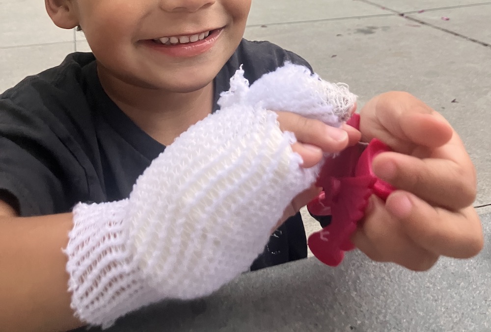Preschooler playing with a small toy. His right hand is bandaged with white gauze.